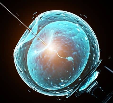 カルタゲナー症候群（PCD)で高齢カップルにお勧めの精子提供プログラム